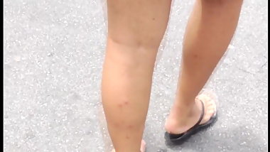 comida pelos moskitos